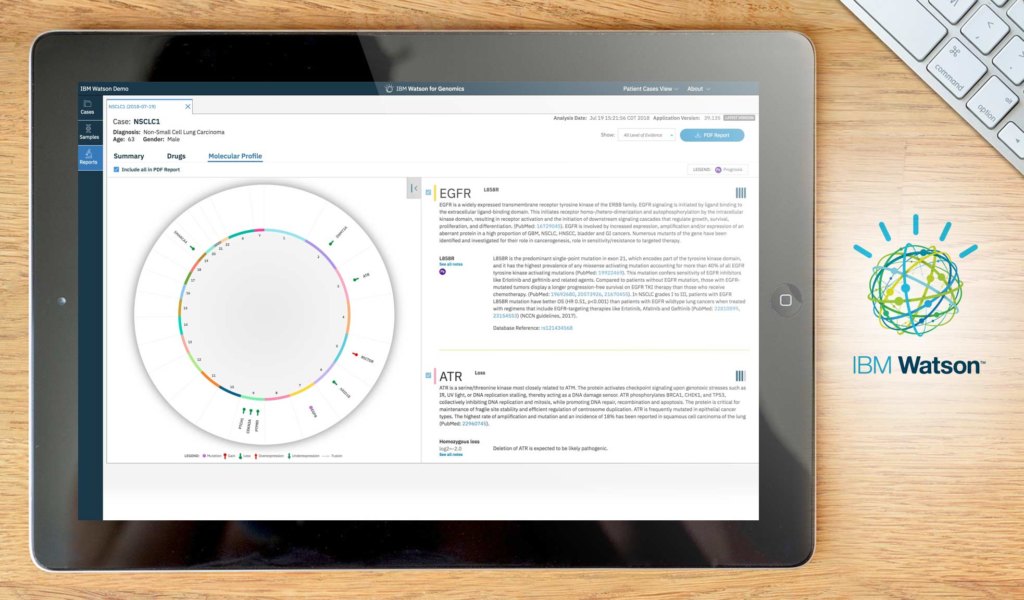 IBM Watson dashboard
